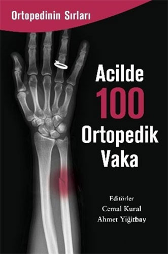 Acilde 100 Ortopedik Vaka